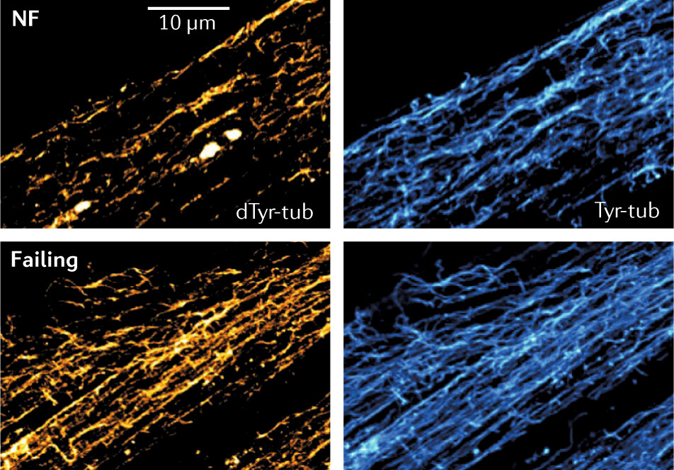 Press for Chen et al., Nature Med 2018