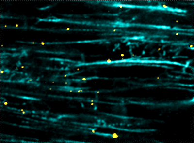 RNA Trafficking RNA